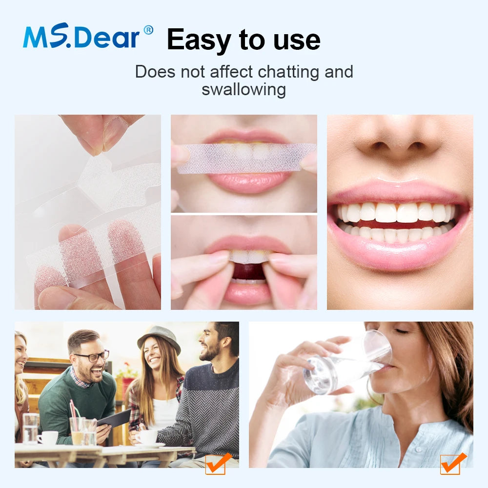 9D Teeth Whitening Strips – Advanced Gel Bleaching & Oral Care